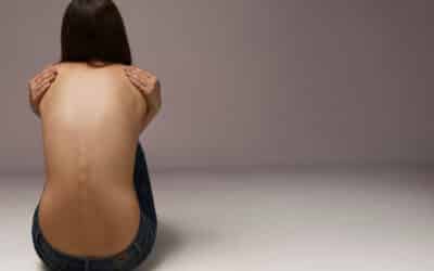Anoressia, Motricità e Postura